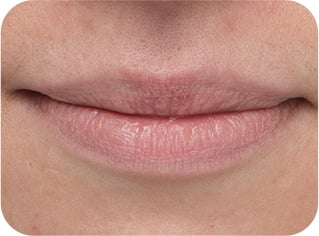 model's lips before using 'BOUNCY & FIRM LIP TREATMENT'